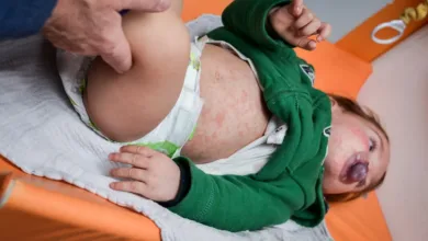 Forgotten Childhood Diseases Vaccines Eradicated